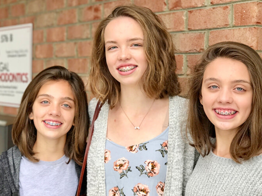 Three girls with braces smiling