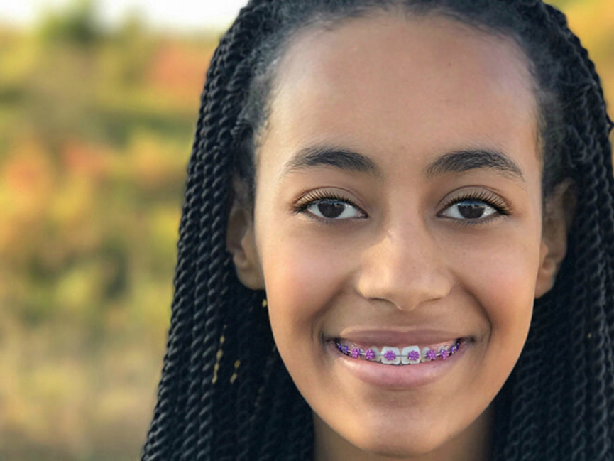 Close up of woman with braces